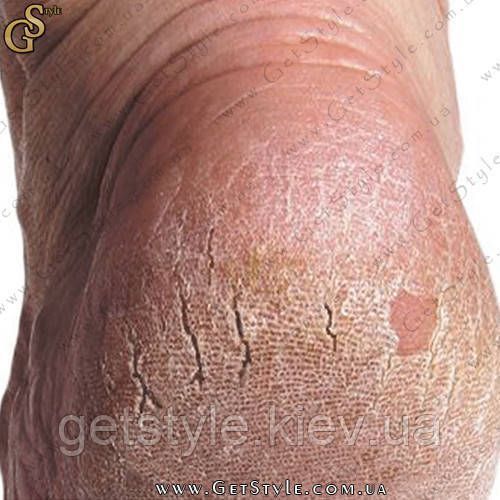 Средство от сухости (трещин) пяток и стоп - "Heel Tastic" 1325 фото